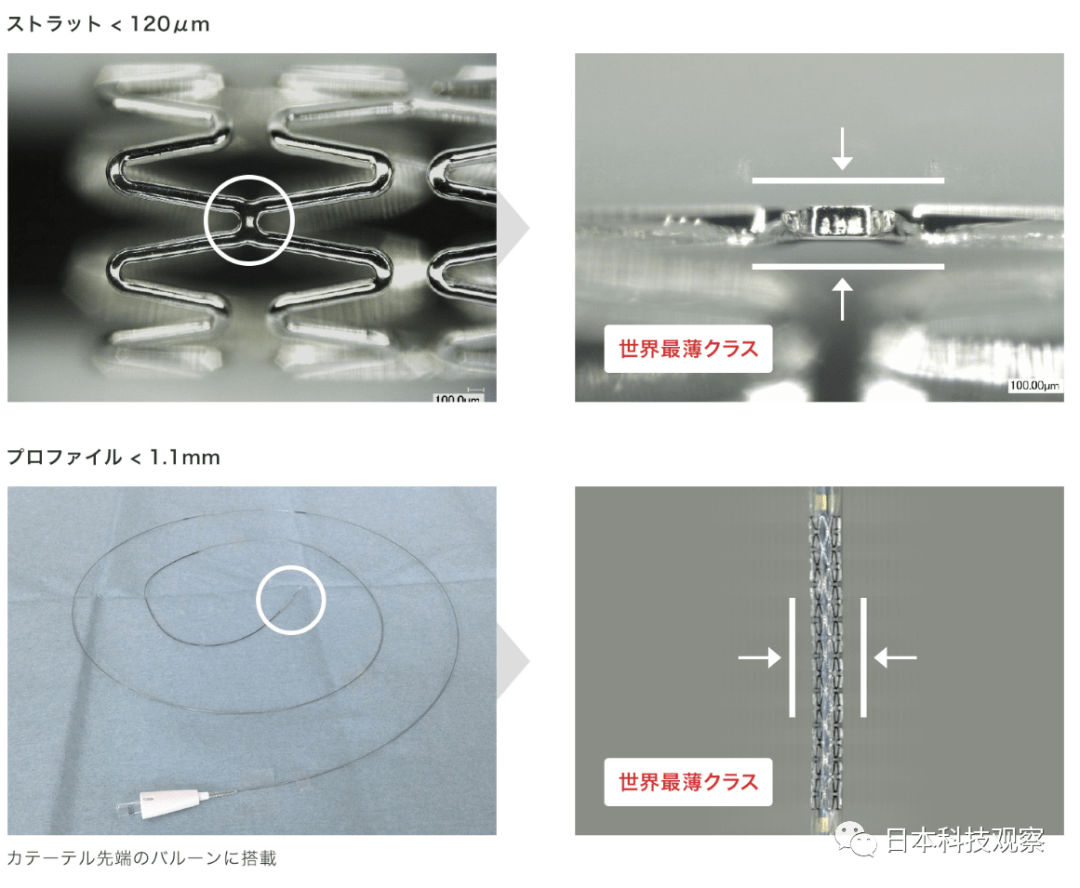 解码最新心梗治疗：技术革新与未来展望