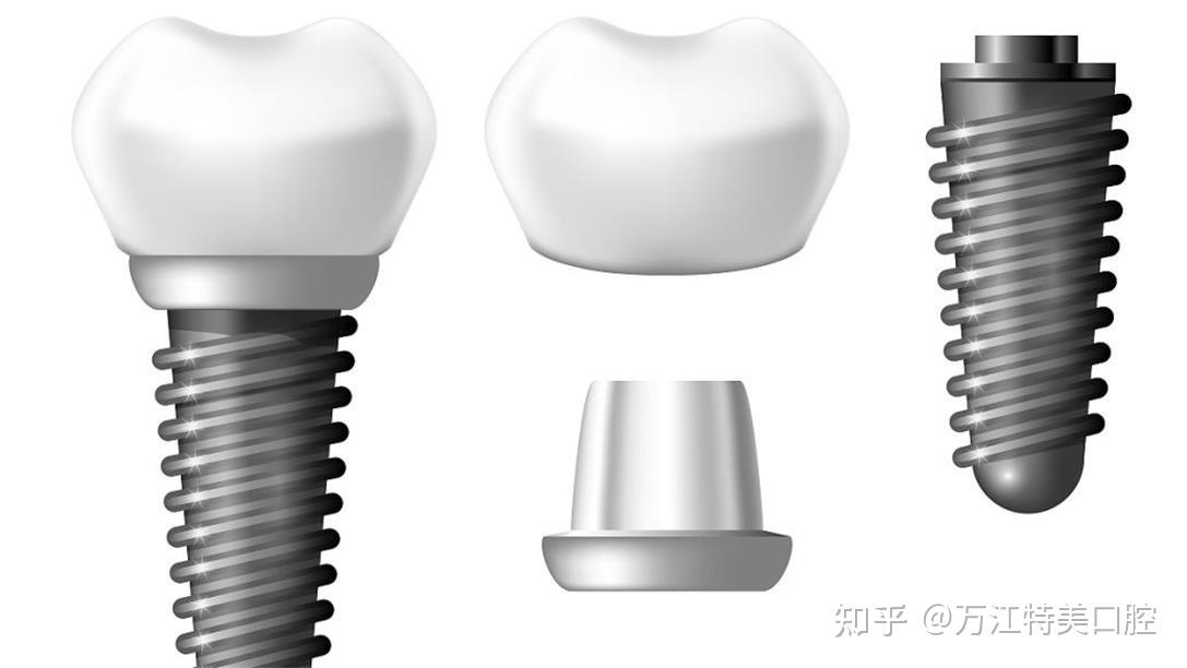 最新种空牙技术的成熟情况分析：优点、隐患和将来发展趋势